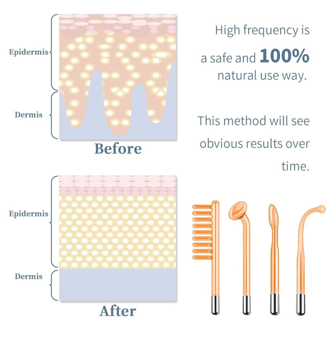 High Frequency Skin Wand + 3 Skin Masks